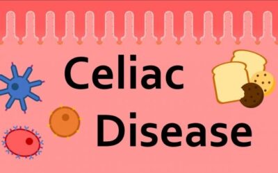 Celiac Disease: Symptoms, Causes, and Treatment